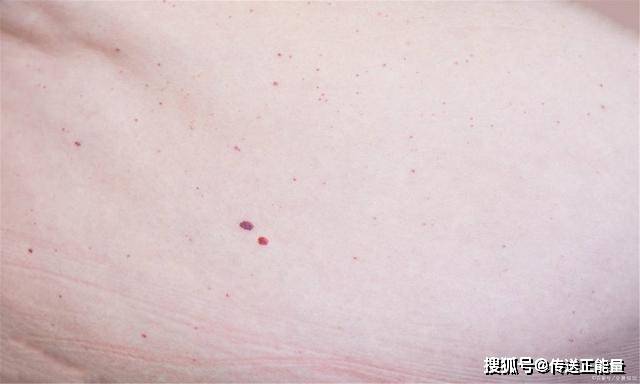 症状|肝癌是“拖”出来的？身体若出现这几“症状”，千万别忽视