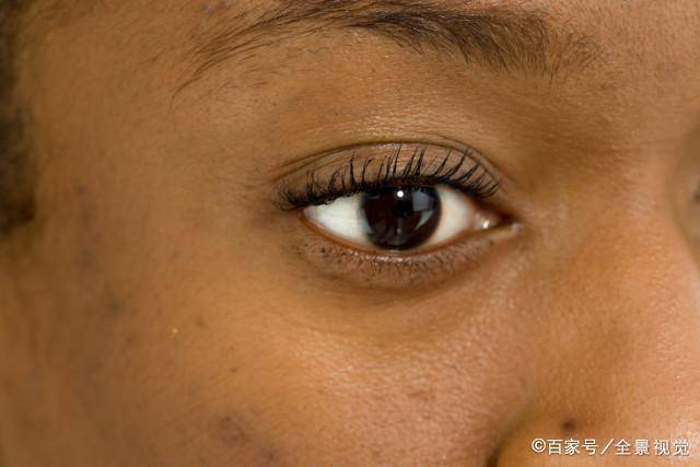 因为|肝病“祸根”没想到是它，“排毒高手”可劲吃，肝毒被连根拔起