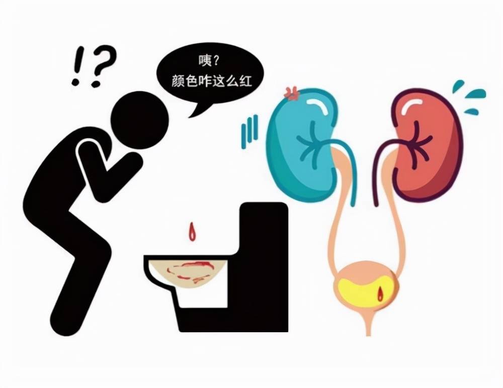 肾脏|慢性病怎么保护肾脏?医生:了解病因及诱因后,保护肾脏,心不慌