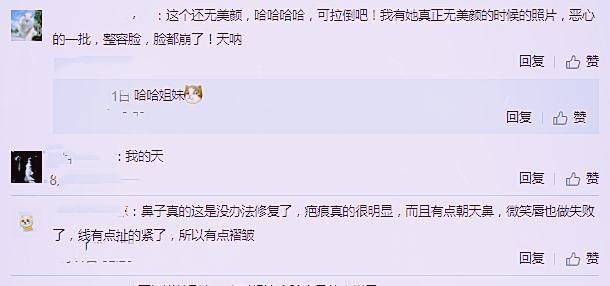 什么|韩安冉无美颜照被疯传，闭口多鼻子疤痕明显，被嘲讽脸崩了