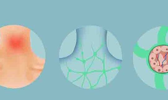 癌症怎么分早晚期 90b01cfb202c461a81906be4c737bf4c.jpeg