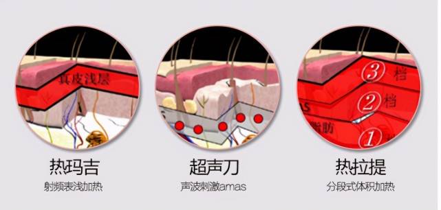 玛吉|深蓝射频好还是热玛吉效果好？该闹闹清楚了！