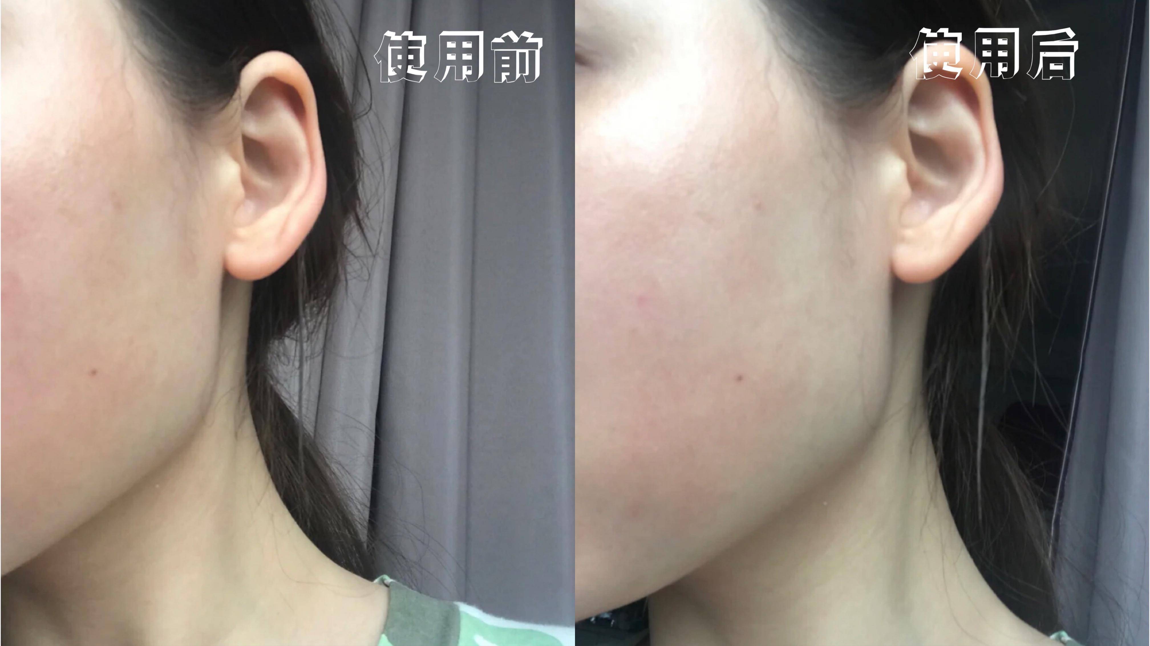 经验教程|换季的面膜得这样用！