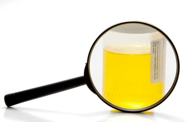 眼睛|频繁牙龈出血，被确诊肝硬化，医生叹息：1事常做，或比酒更伤肝