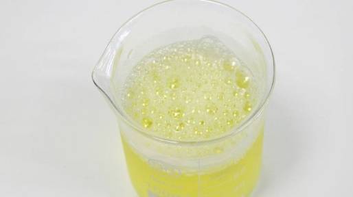 肾脏|尿毒症来的悄无声息?身体这3个“变化”若及时发现,可能会远离