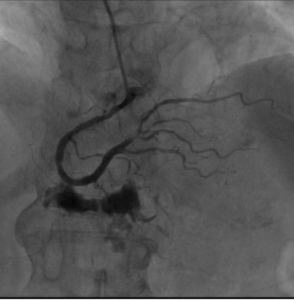 治疗|精准评估，多学科诊疗护佑老年患者健康