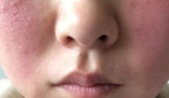 面色|血糖高的人，脸上若没有这4个“变化”，恭喜你！状态可能还不错