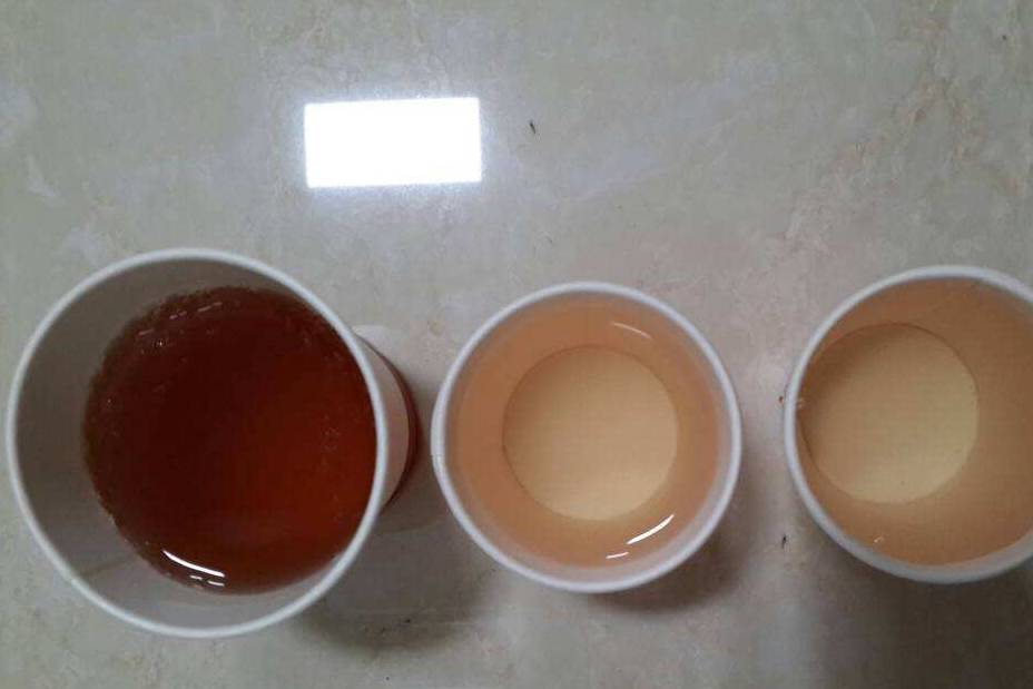 癥狀|尿酸高的人，身體若出現這3種癥狀，可能已牽連腎臟，別忽視了