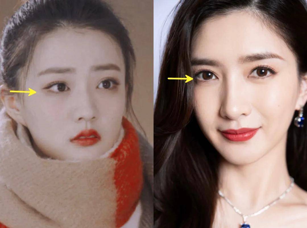 因为|姐妹，双眼皮再好，咱也别硬割啊！
