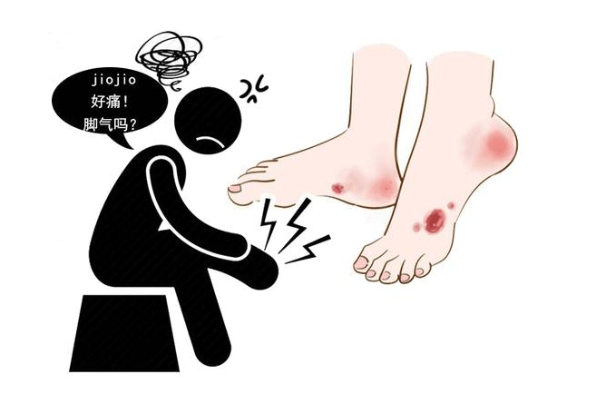 血管|糖尿病足有截肢可能？糖友保护好脚，最好4件事提上日程