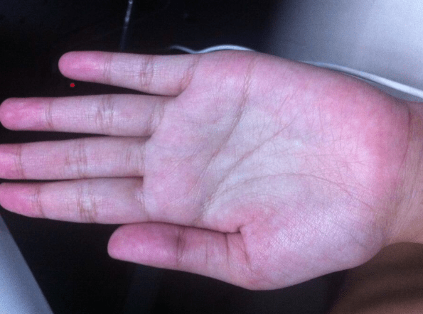 症状|如何判断自己肝脏是否健康？中医：这还不简单，7个方法收藏好