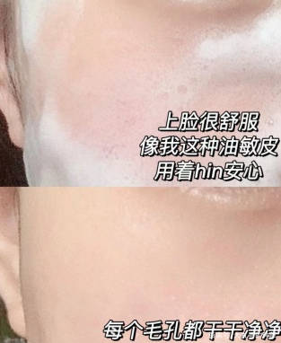 no|氨基酸洗面奶大揭秘！不要再被骗了，真正的氨基酸洗面奶是它们