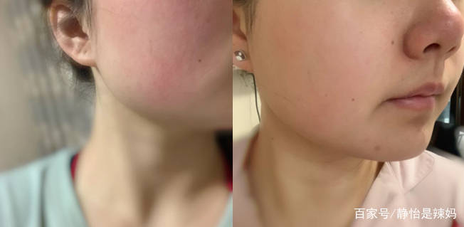 品牌|孕期护肤品品牌哪个好？别盲目跟风大牌，这些护肤品平价又好用