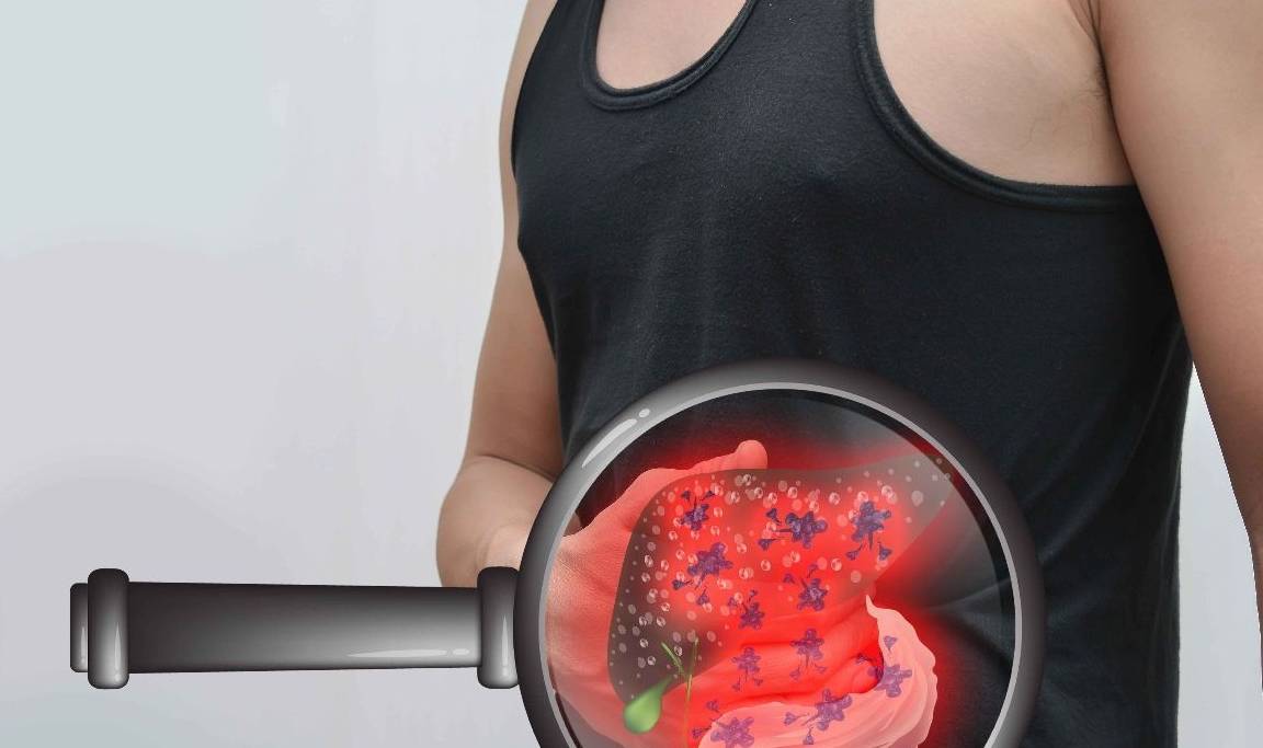 肝脏|肠胃发出的3个信号，是肝脏病变的警讯，别错当肠胃病治