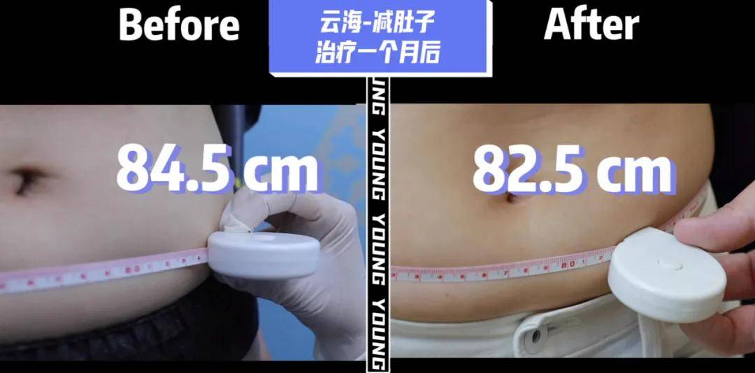 效果|孔雪儿怎么肿成这样？这是填充失败了吗？！