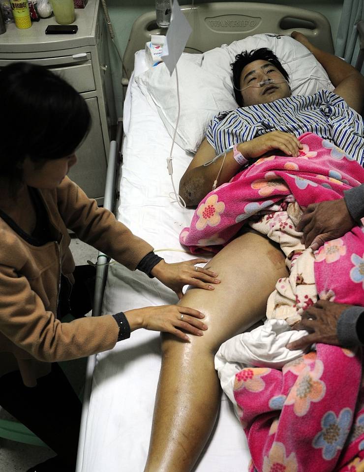 肾脏|26岁男子确诊肾衰竭,竟是“拖”出来的,肾病这4个信号不可忽略