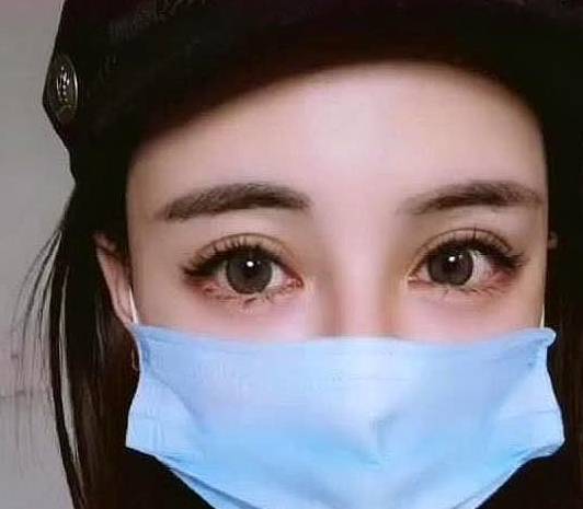 眼睛|女子整容成洋娃娃脸，闭上眼睛那一刻后悔了，网友：瞎折腾！