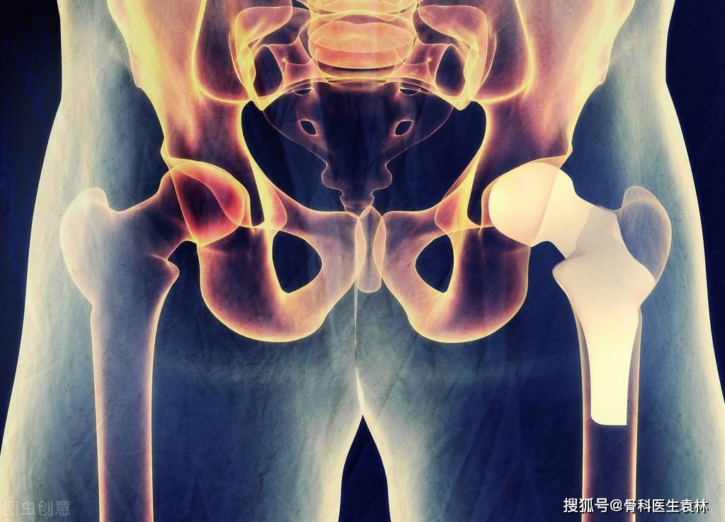 什么是滑膜炎 fc974b5cb24c48f8bca24c184b2ec447.jpeg