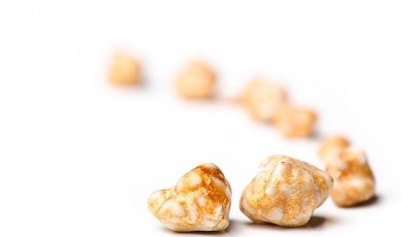 零点|肾结石如果不痛，就不用理睬？这2个危害可不小