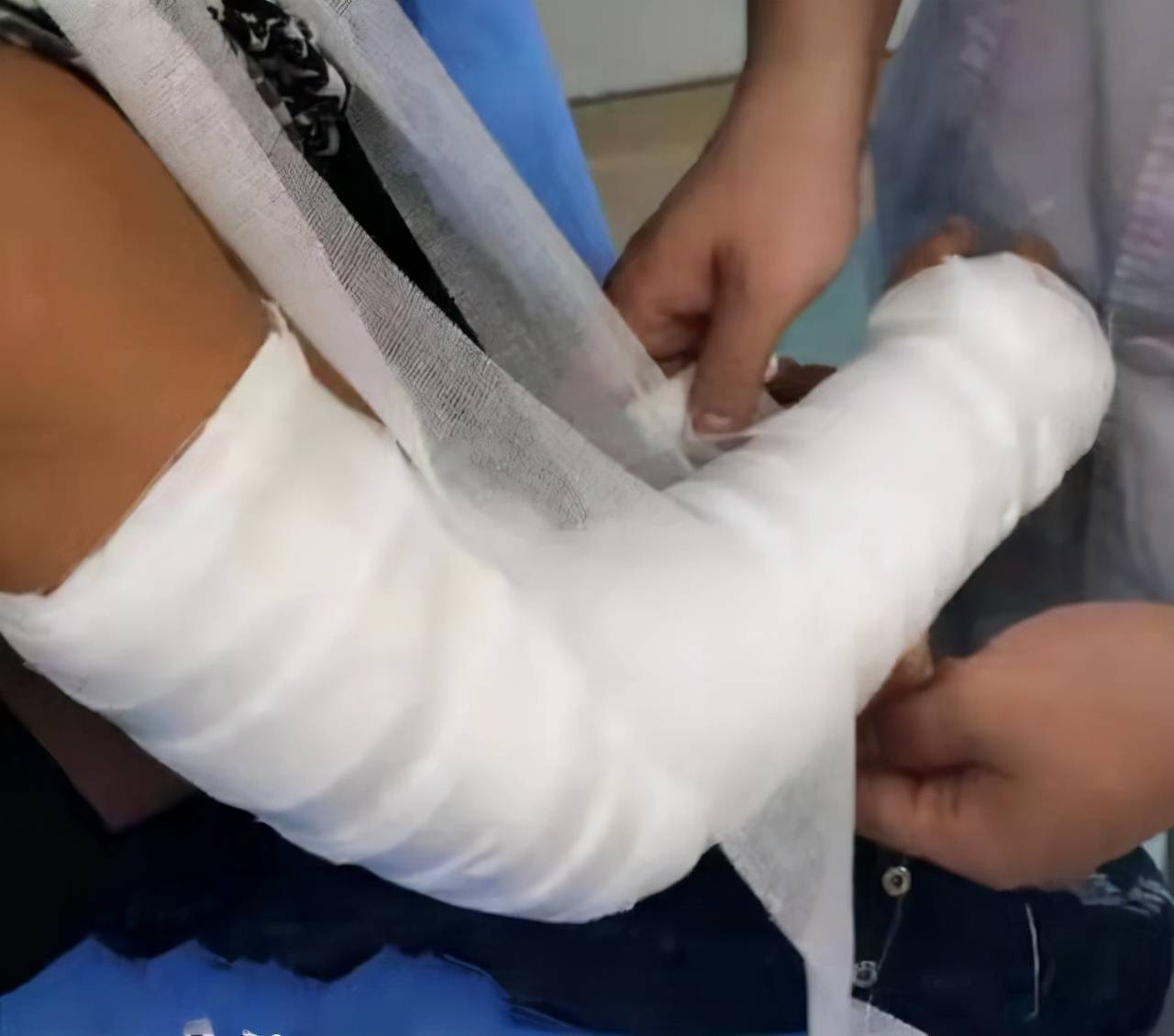 小学生体育课跑步骨折,校方赔偿8万,老师瑟瑟发抖:建议取消_孩子