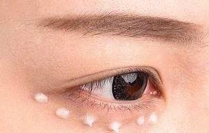 子宫|女人的衰老从35岁开始,做好四件事,会让你比同龄人更年轻!