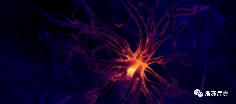 症状|渐冻症治疗：虽然身躯逐渐冰冻！但灵魂永远不屈！