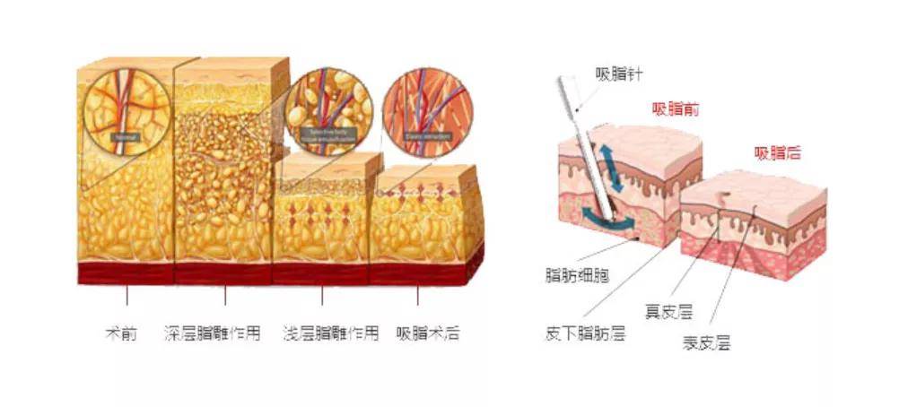 出圈|刚要凭演技出圈的她却因为一个小动作差点凉了…