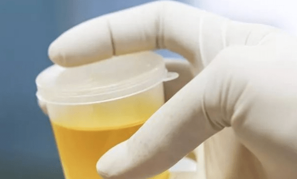 肝功能|肝不好的人，身体会弹出8个信号！哪怕占一个，也要开始养肝