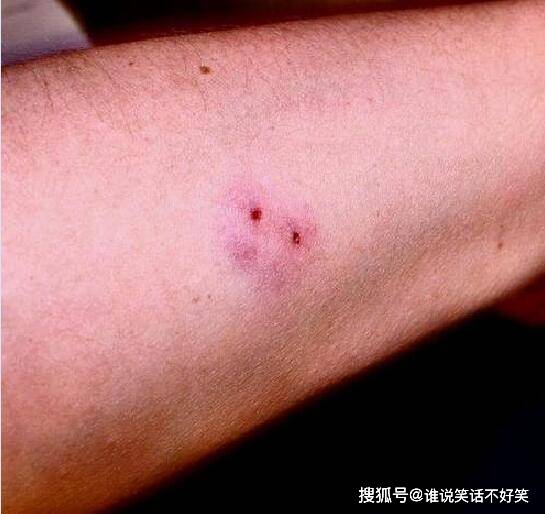 原创蛇酒变成夺命酒泡酒12个月农民开瓶后却被咬身亡蛇为何没死