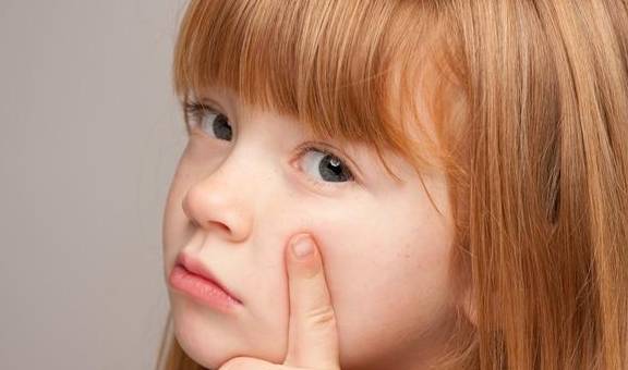 吃什么能减少雀斑 4077acfa5d0b4d12866cb3544c3240f3.jpeg