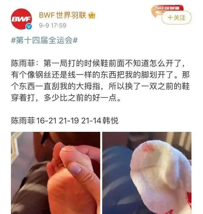 产品|划伤奥运冠军，李宁又翻车了