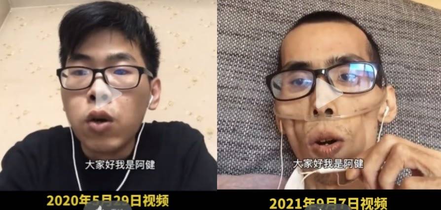 悼念33岁抗癌博主小杨哥，生命的勇气与坚韧
