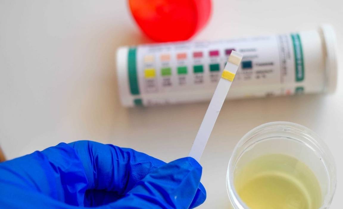 肾脏|尿液一旦“透露”出异常，需当心，这或是肾病的早期信号！