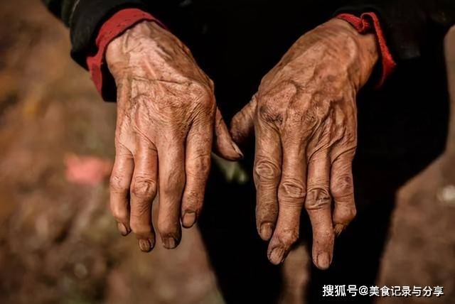 人体摄入总氟量每天超过4mg时即可引起慢性氟中毒,原本在机体各部分