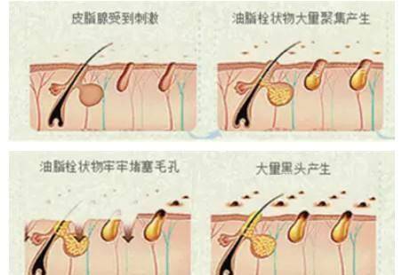 黑头|金晨是牛奶“泡大”的？穿吊带裙藏不住“水光肌”皮肤嫩得要出水