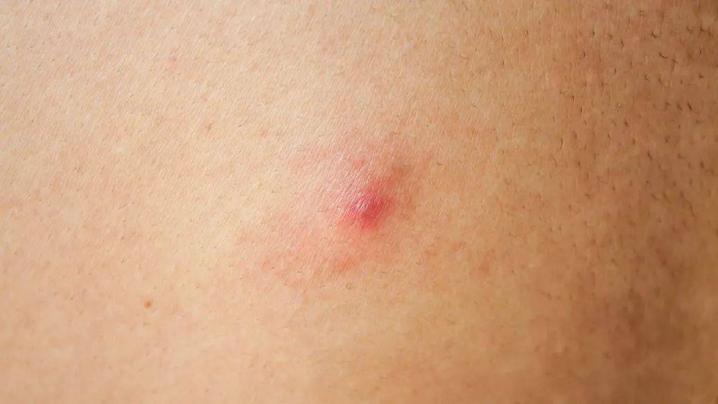 小逸|人人以油养肤,卸妆水真的退出历史舞台了吗?