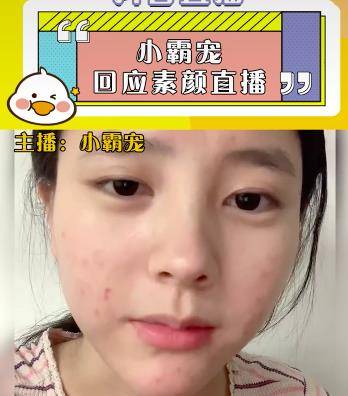 化妆品小霸宠首次透露素颜直播原因，审美跟大家不同，觉得满脸痘很好看