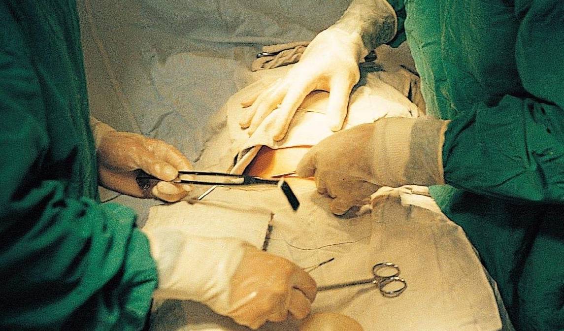 因为|同样是生孩子,为什么二胎要比头胎疼太多?其实原因很现实