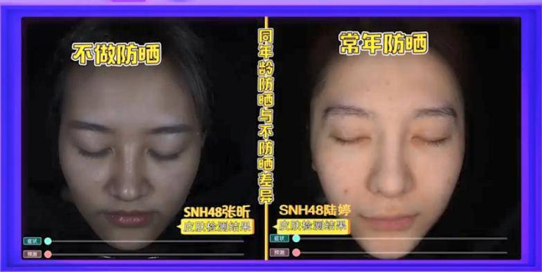 因为坚持用了“4年”防晒霜，皮肤发生了“大改变”，不止变白了