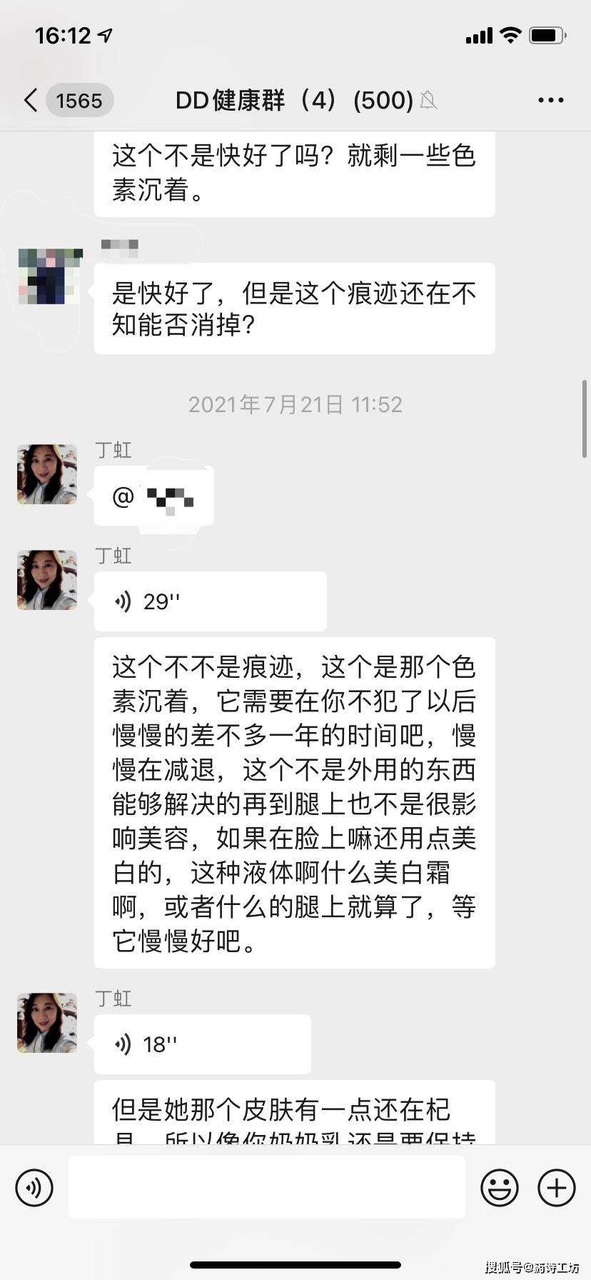 什么箹诗工坊:孩子腿上色素沉着，应该如何改善？