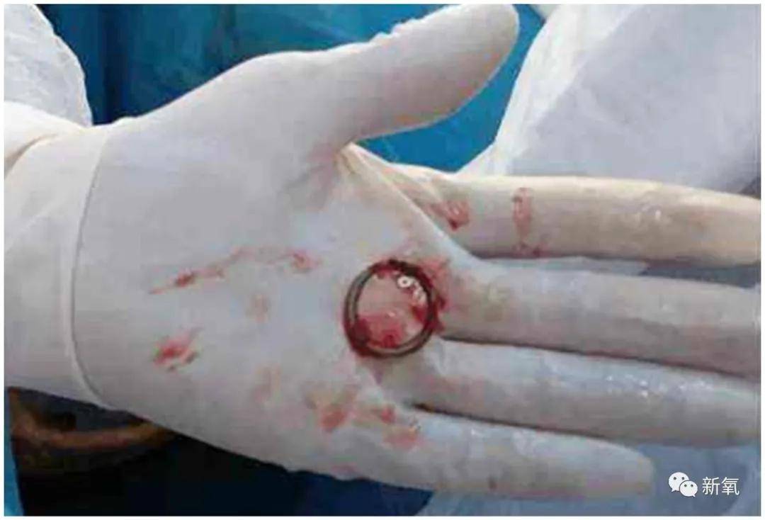 时间|你妈妈的身体里，也有这个吗？？？