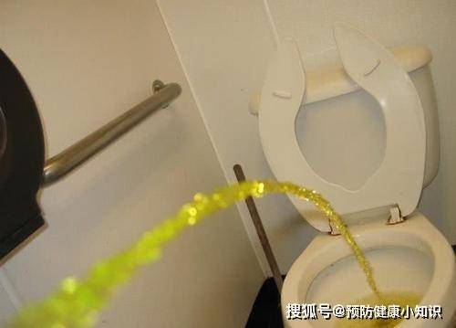 睡眠|生活中4个行为或会伤肝，坚持“三多”，肝会感激你