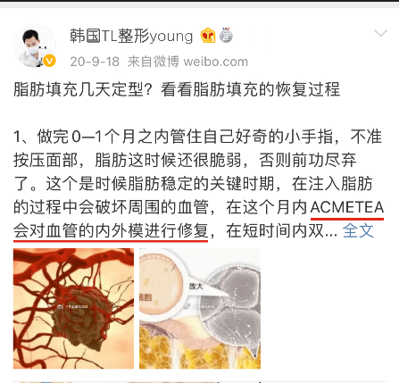 充术解锁：面部填充优点，自体脂肪男生填充注意事项！