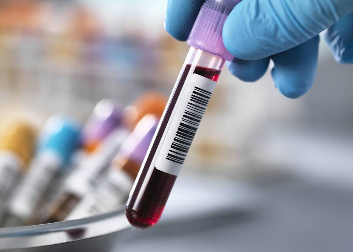 心脑血管|长期服用“他汀”，身体会发生什么变化，要注意什么？