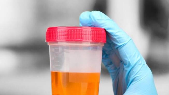 方案|肾病想尿蛋白降得快，4点秘诀收好，是避开肾衰竭的关键