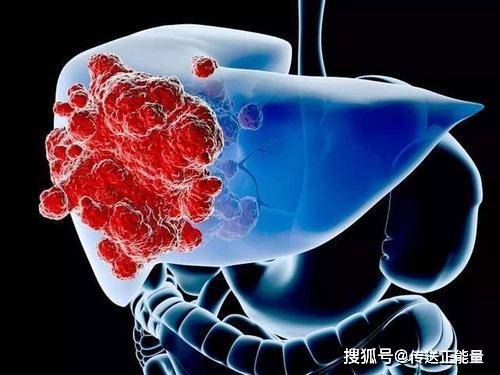 知识科普|肝有癌,身体知!若身体出现6个“异常”,及时检查
