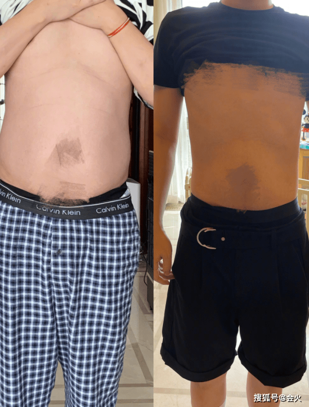 近照|张大大4个月暴瘦30斤！称永不吃膨化食品和卤味，近照肚腩瘦一圈