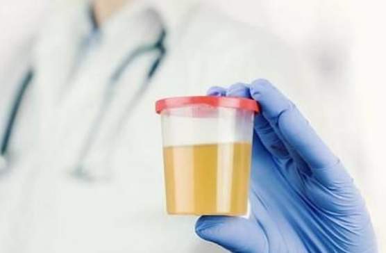 怎么样才算尿泡 34263d512a544af3ac7420118bd3153e.jpeg