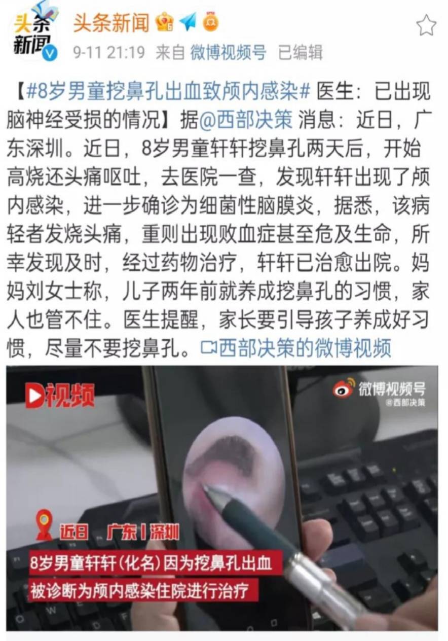 鼻子|8岁男童频繁挖鼻孔，竟致细菌性脑膜炎！大人小孩都要注意