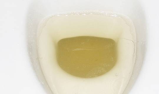 怎么能快速有尿意 d808ecced9834d37b9d5334030378be6.jpeg